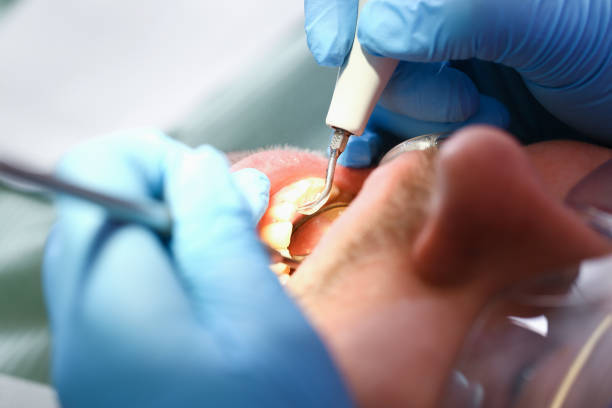 Best Emergency Care for Gum Disease in Berkeley, MO